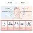 Facial Muscle Trainer & Jawline Exerciser